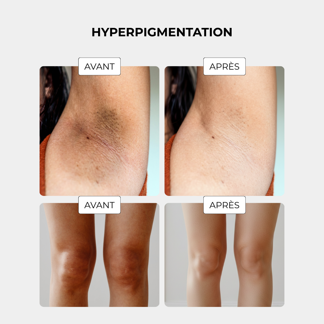 Coffret Gant Exfoliant en Soie - Corps + Visage