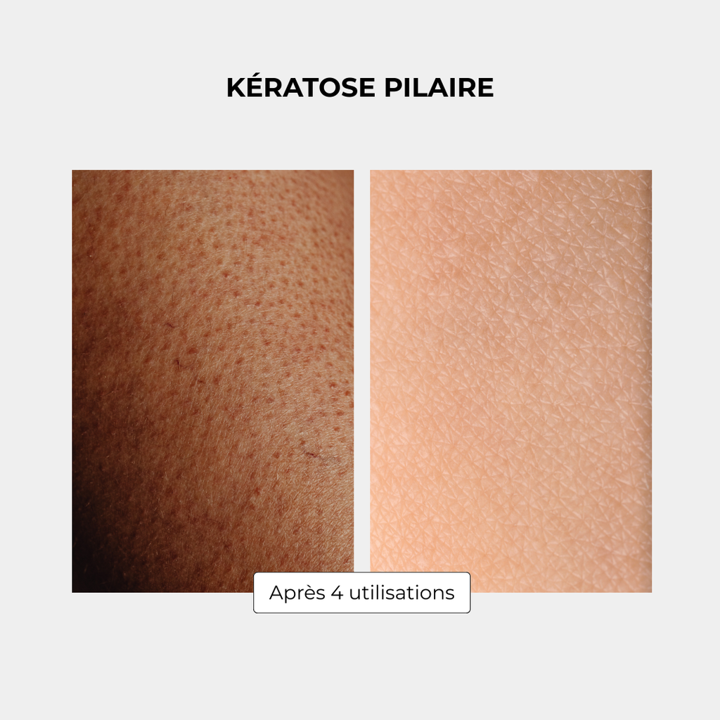 Coffret Gant Exfoliant en Soie - Corps + Visage